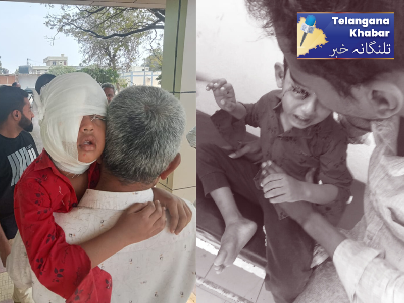 میدک۔ کتوں کے حملہ میں 4سالہ لڑکا زخمی