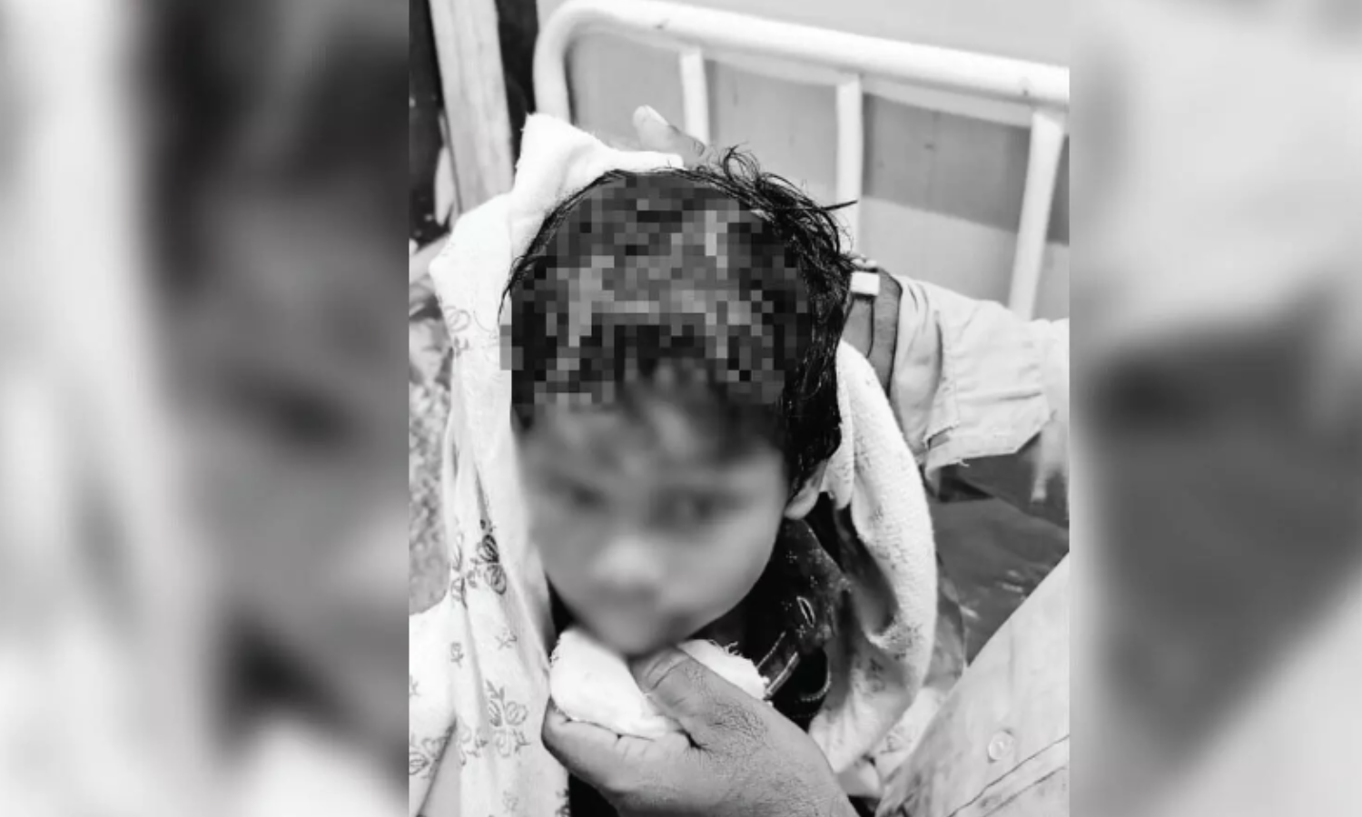 گدوال میں آوارہ کتے کے حملے میں چھ سالہ بچہ شدید زخمی